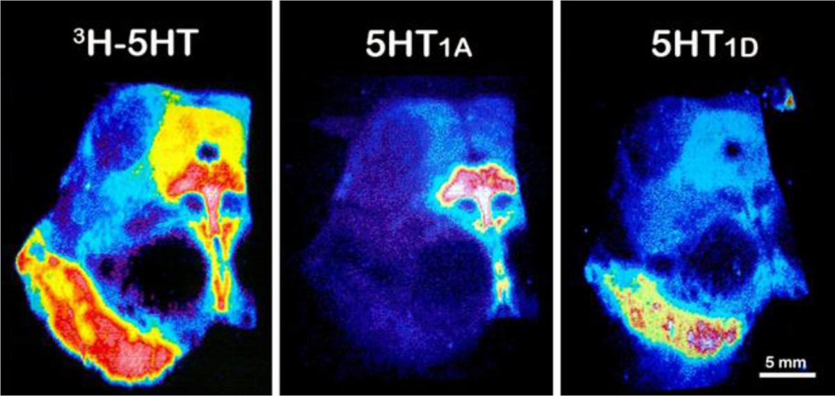 El Cerebro y la Bomba Atómica.  La Neurociencia y la Guerra Fría