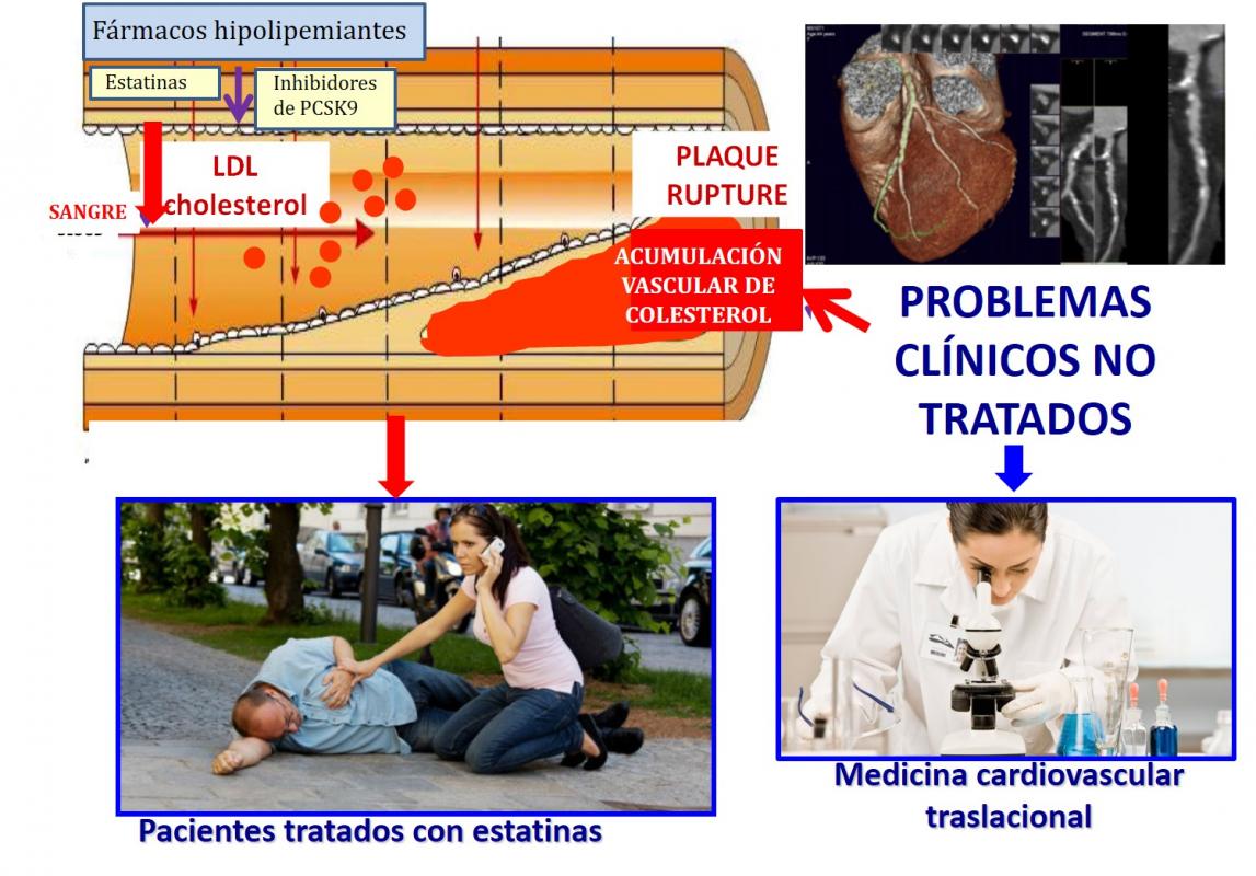 Desenvolupament de nous biomarcadors per a diagnòstic i tractament de malaltia cardiovascular